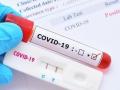 "Giới chủ" đứng sau hệ sinh thái doanh nghiệp chi hàng nghìn tỷ nhập khẩu kit test COVID-19