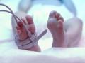 Phát hiện mới giúp điều trị tổn thương não ở trẻ sơ sinh
