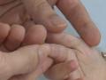 Bà Rịa - Vũng Tàu ghi nhận ca tử vong đầu tiên do tay chân miệng