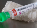 Vì sao bệnh đậu mùa khỉ đột ngột lây lan trên thế giới và liệu virus đã biến đổi?