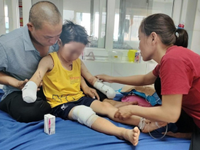 Bé trai 8 tuổi bị thương nặng, mất hai bàn tay sau tiếng nổ lớn