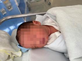 Lần đầu tiên tại Việt Nam, ca sinh con của bà mẹ bị ung thư cổ tử cung