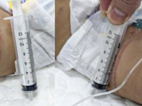 Sức khỏe bé gái 18 tháng tuổi nghi bị bạo hành tại Hà Nội giờ thế nào?