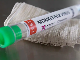 Vì sao bệnh đậu mùa khỉ đột ngột lây lan trên thế giới và liệu virus đã biến đổi?