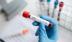 Người phụ nữ đầu tiên khỏi nhiễm HIV sau khi được ghép tế bào gốc