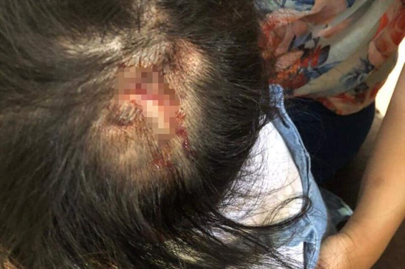 Cháu T. bị đánh thương tích trên đầu. Ảnh: TT.