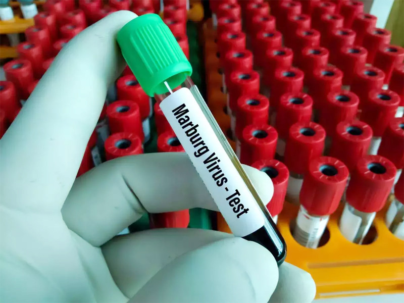 loai virus khien 9 nguoi tu vong o guinea xich dao nguy hiem ra sao loai virus khien 9 nguoi tu vong o guinea xich dao nguy hiem ra sao